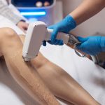 A person getting laser hair removal A person getting laser hair removal