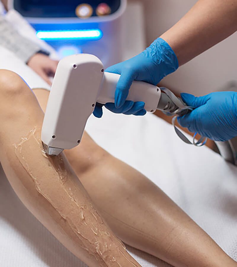 A person getting laser hair removal A person getting laser hair removal