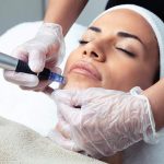 a woman getting microneedling a woman getting microneedling